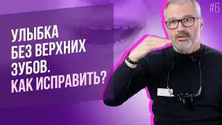 Не видно верхних зубов при разговоре и улыбке. Как исправить?