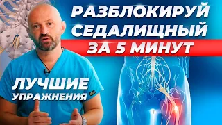 Защемило СЕДАЛИЩНЫЙ НЕРВ: Срочно делайте упражнения дома