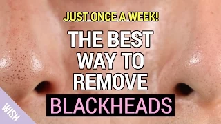 Ultimate Blackhead Removal & Preventing Tips | How to Remove Blackheads Properly