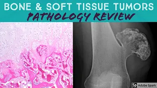 Bone & Soft Tissue Pathology Board Review (21 Classic Cases)