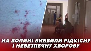 «Вражає весь організм» ❗️❗️ На Волині виявили РІДКІСНУ І НЕБЕЗПЕЧНУ ХВОРОБУ