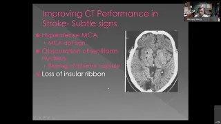 Stroke: The Role of CT and MRI in Diagnosis and Treatment