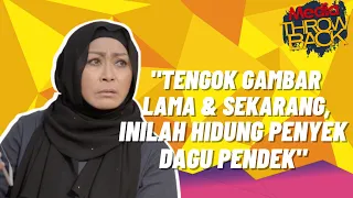 “Boleh Tengok Gambar Lama Dan Sekarang, Inilah Hidung Penyek, Dagu Pendek...,” - Liza Abdullah