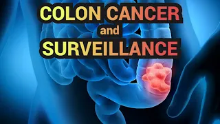 Colon Cancer and Surveillance - CRASH! Medical Review Series