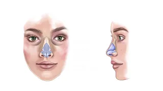 1 Anatomy of the nose