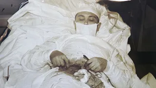 Episode 179: Self Surgery: Leonid Rogozov Removed His Own Appendix