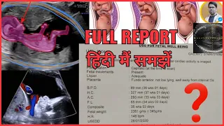 PREGNANCY ULTRASOUND REPORT IN HINDI/PREGNANCY ULTRASOUND REPORT कैसे देखते हैं/PREGNANCY REPORT