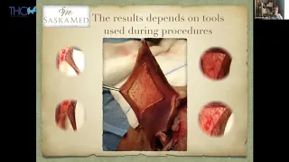 About Labia Minora Reduction Full Lecture By Dr Rafal Kuzlik