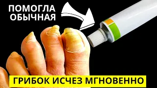 Эта ЯДРЁНАЯ Советская Мазь Разъест Весь Грибок с Ногтей! Есть в Любой Аптеке!