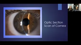 Lecture: Using the Slit Lamp Microscope to Visualize the Ocular Structures