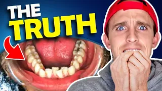 Bad experience with Smile Direct Club...WATCH BEFORE YOU BUY! Orthodontist REACTS