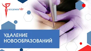 Удаление новообразований. СО2 лазер: преимущества и методы обработки кожи