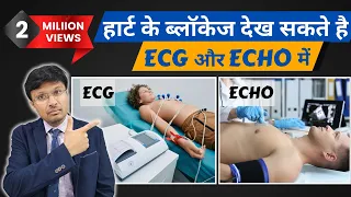 Can ECG and echocardiogram detect heart blockage?(Must Know facts..)