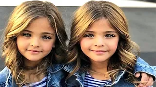 5 Most Unusual and Beautiful Kids in the World