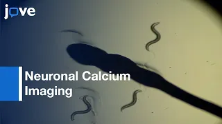 In Vivo Neuronal Calcium Imaging | Protocol Preview