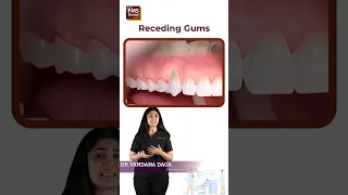 Can you fix receding gums? why does this happen? Dentistry dental gum myths | FMS Dental