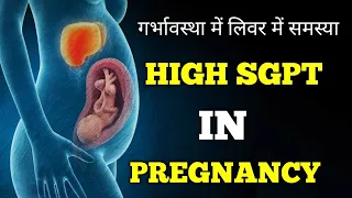 Sgot Sgpt High In Pregnancy | प्रेग्‍नेंसी में लीवर में आ गई ये प्रॉब्‍लम | high sgpt in pregnancy