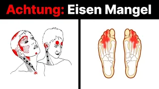 Anhand dieser 5 Anzeichen erkennst du, ob du einen Eisen-Mangel hast!