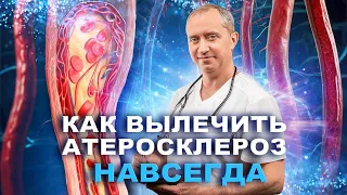 Как вылечить атеросклероз?