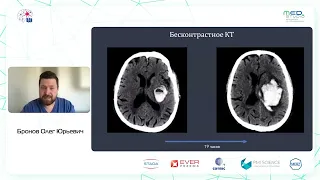 Предикторы роста внутричерепной гематомы. д.м.н., проф. Бронов О.Ю.