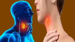 Throat Cancer: Types, Stages And Survival Rate