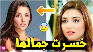 الحسناء هاندا أرتشيل تصدم جمهورها بتغير ملامحها بالكامل بسبب الانتقادات