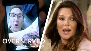 Dr. Dubrow Used Leeches to Suck Blood Out of Patient's Foot?! | Overserved | E!