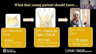 04 - Surgical Aortic Valve Replacement: What does the future look like - Ibrahim Sultan, MD
