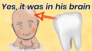 How a Tooth Was Found Inside a Boy's Brain