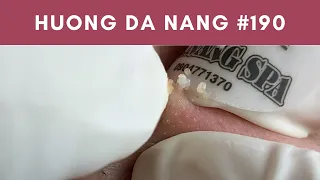 #190 | Huong Da Nang