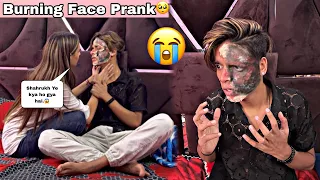 BURNING FACE PRANK || PRANK ON GIRLFRIEND || सोचा नहीं था एसा भी होगा 🥺|| SHAHRUKH LOVE