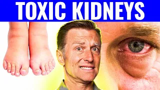 7 Warning Signs That Your Kidneys Are Toxic