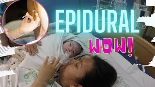 EPIDURAL | GIVING BIRTH EXPERIENCE😷