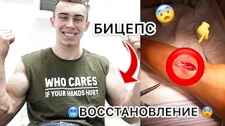 ВОССТАНОВЛЕНИЕ ПОСЛЕ ОТРЫВА СУХОЖИЛИЕ? МОЙ ОПЫТ!