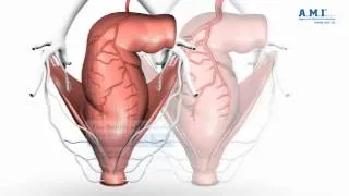 piles: nature of hemorrhoids - understanding haemorrhoids and therapy