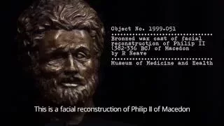 Cast of facial reconstruction of Philip II of Macedon, Museum of Medicine and Health