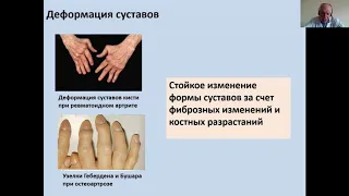 Дифференциальный диагноз при суставном синдроме