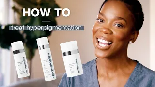 How to treat hyperpigmentation