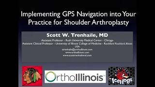 Implementing GPS Navigation Into Your Practice for Shoulder Arthroplasty