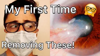 Day in the Life of Young Eye Doctor | My First Minor Surgery Day