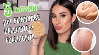 5 CONSIGLI PER ELIMINARE CELLULITE E FOLLICOLITE ❌