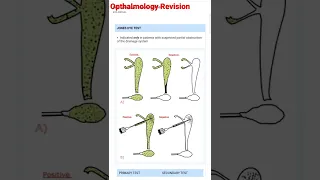 #mbbs Opthalmology (Jones dye test)NEETPG