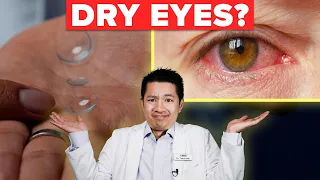 How Scleral Lenses Can Help Your Dry Eyes!!