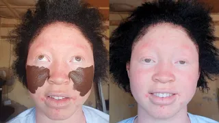 Viral Bomb 👉😱 Makeup And Hair Transformation 💉 Cirurgia Plastica ✂️🔥 Makeup Tutorial 😳