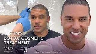 Justin, 35— BOTOX® Cosmetic Treatment Journey