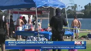 Man Slashed During Family Fight At Ski Beach