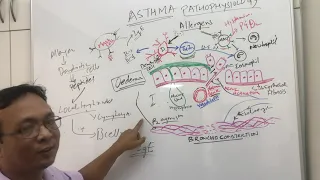 Asthma(Bronchial Asthma):pathophysiology(Ref:Harrisons Internal medicine and Robins pathology)