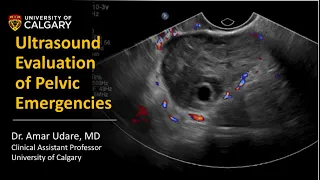 Ultrasound Evaluation of Pelvic Emergencies - Radiology Review