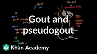 Gout and pseudogout | Muscular-skeletal diseases | NCLEX-RN | Khan Academy