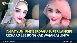 Ingat Yuni Jasmine PNS Berdagu Super Lancip? Richard Lee Bongkar Wajah Aslinya, Ternyata Seperti Ini